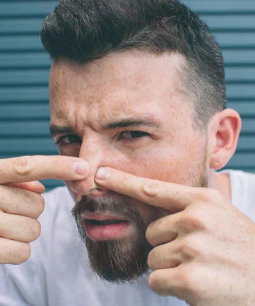 How To Get Rid Of Nose Blackheads In Men