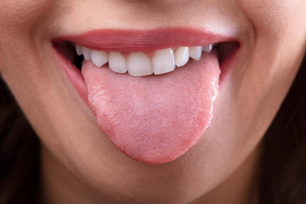 What Questions to Ask If You Have A Scalloped Tongue