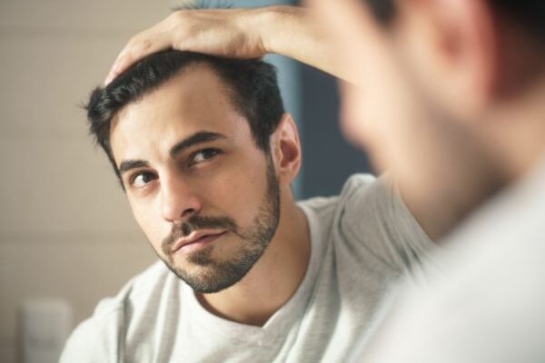 How to Minimize Balding