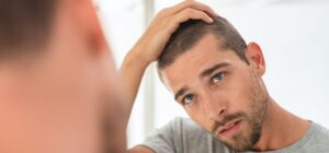 Hair Loss In Men ─ 7 Causes And Treatment Options