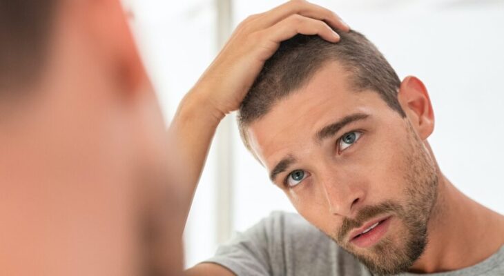 Hair Loss In Men ─ 7 Causes And Treatment Options