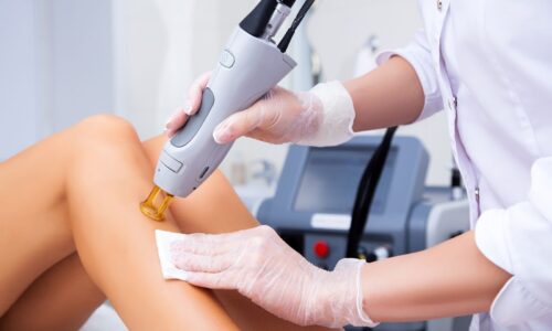 IPL Hair Removal Demystified: Your Comprehensive Guide to At-Home Machines