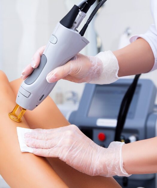 IPL Hair Removal Demystified: Your Comprehensive Guide to At-Home Machines